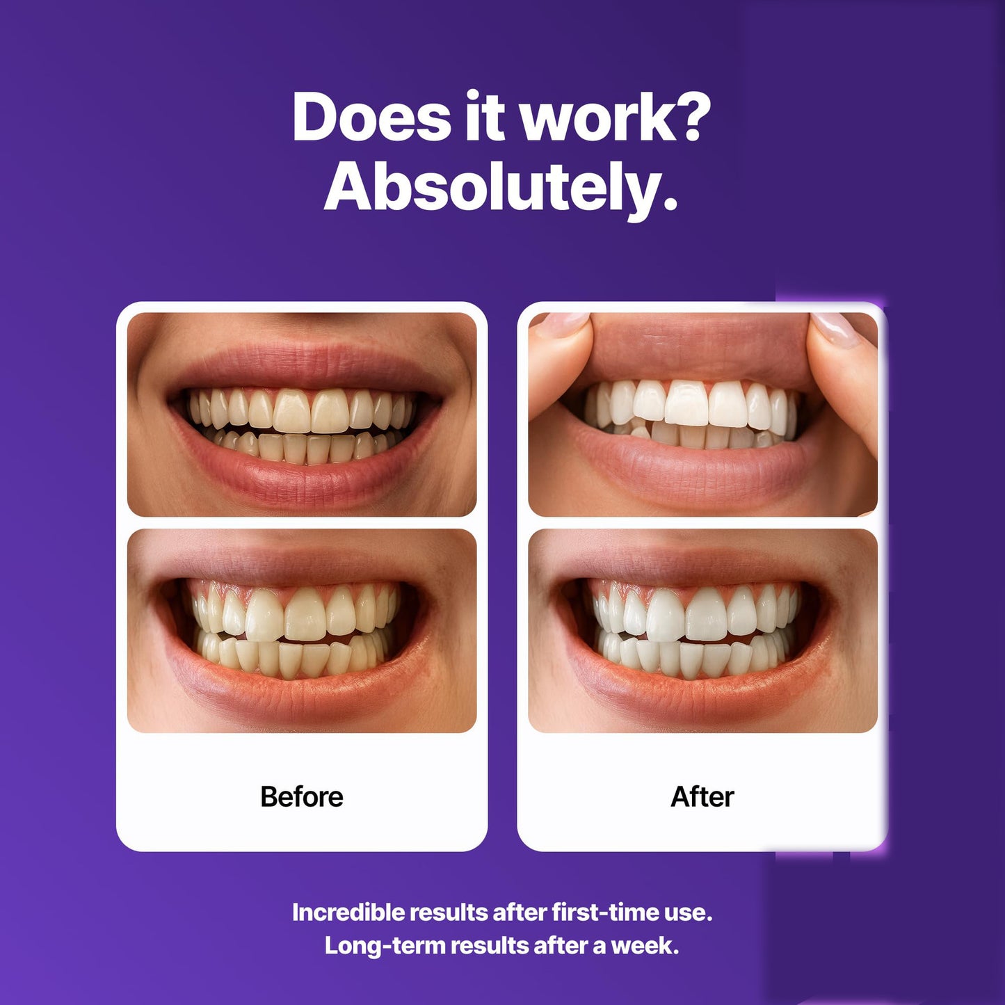 Dr Dent Teeth Whitening Strips