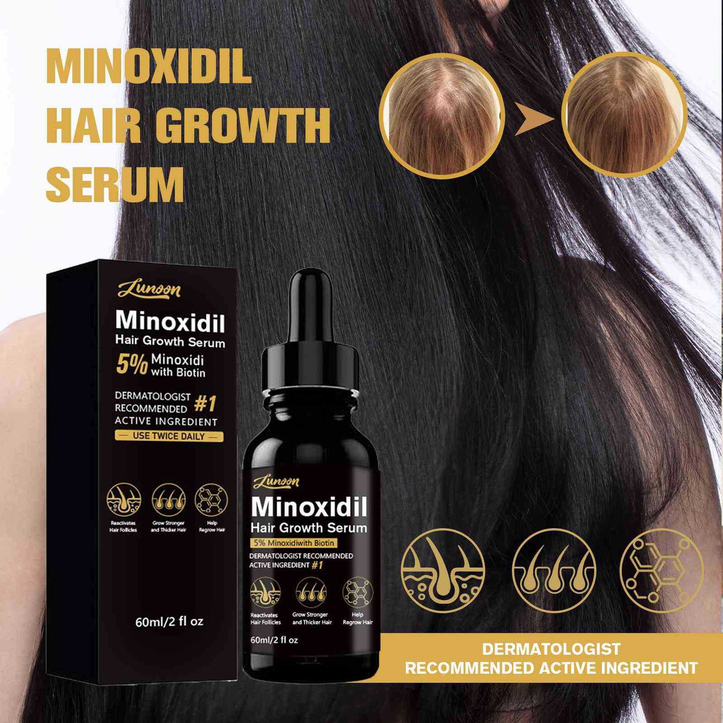 Minoxidil Hair Growth Essence Serum