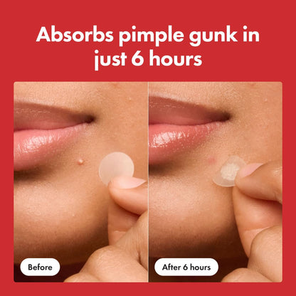 Mighty Pimple Patch