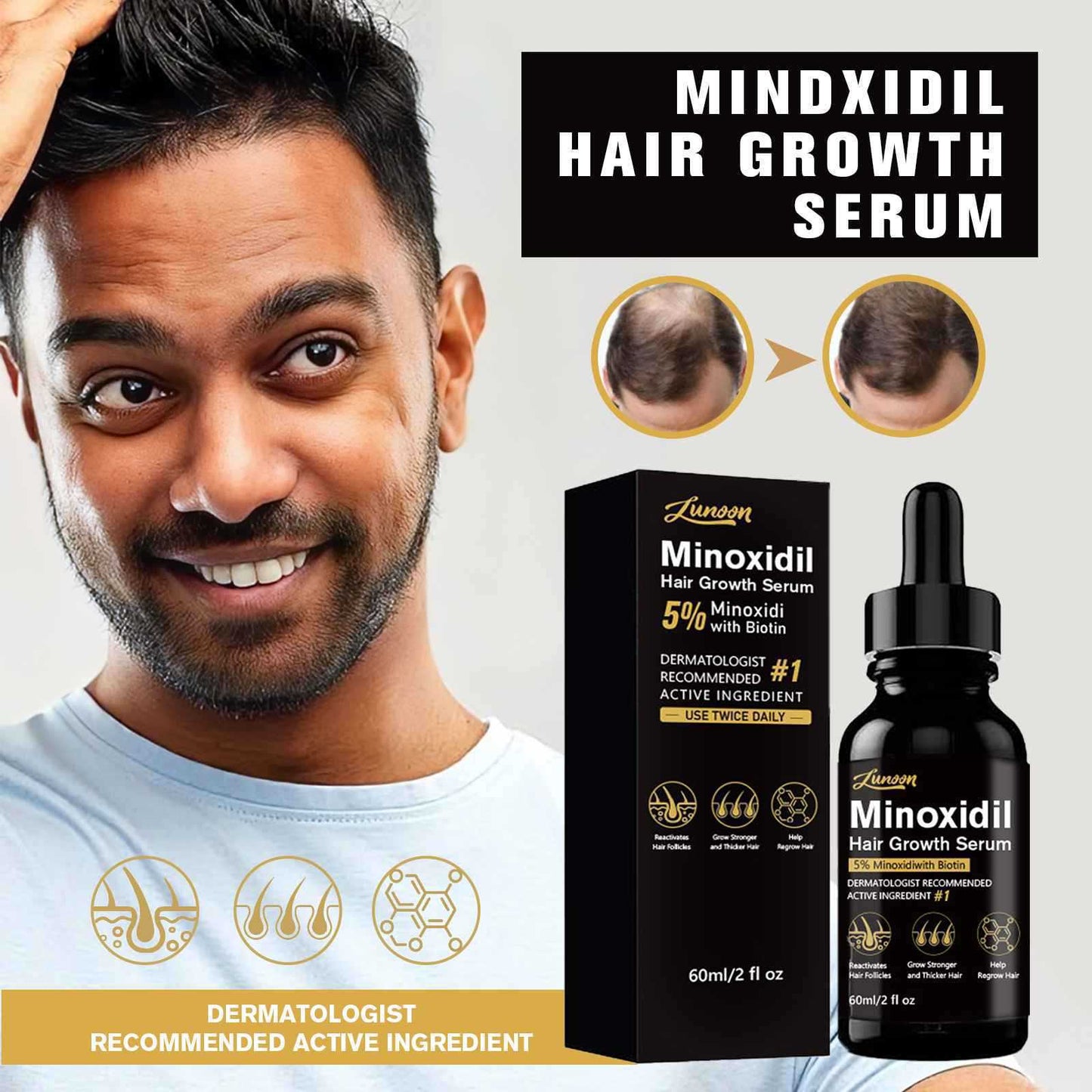 Minoxidil Hair Growth Essence Serum